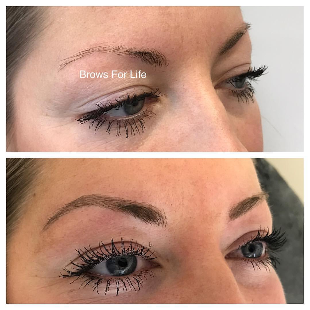 Custom brow design